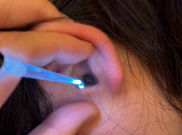 探索耳屎形成的秘密,你了解多少? - 品悦舍