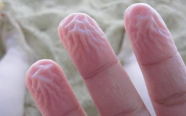 手指在水里泡久了,皮肤为什么会起皱 - 品悦舍