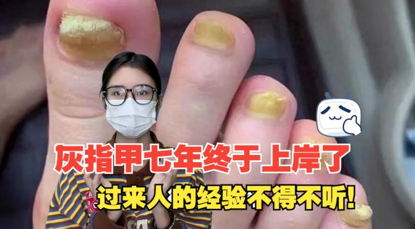 为什么人类会长灰指甲? - 品悦舍