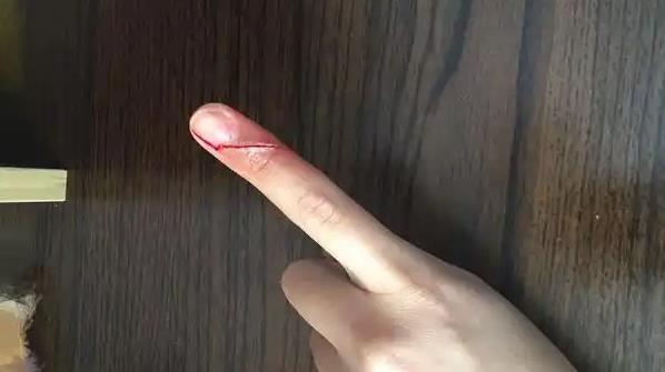 为什么手指被纸片割伤,比刀子划伤还要痛? - 品悦舍