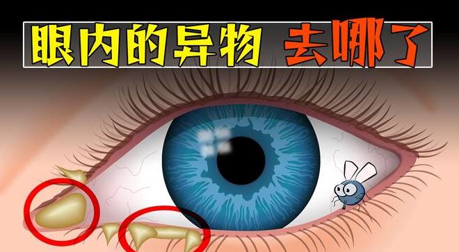 飞进眼睛的异物,消失去哪了? - 品悦舍
